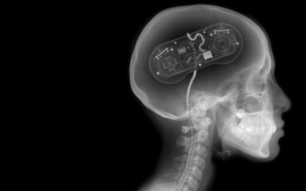 gamer brain